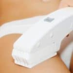 Depilado Laser
